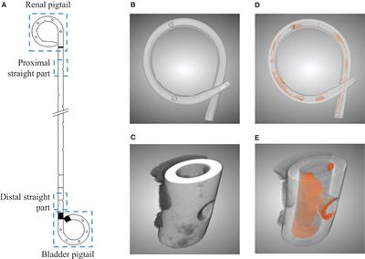 Quantitative Evaluation of Encrustations in Double-J Ureteral Stents With Micro-Computed Tomography and Semantic Segmentation